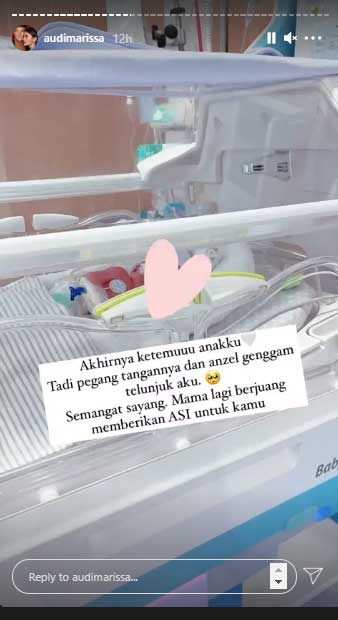 foto-anak-bayi-prematur-audi-marissa dan anthonie xie