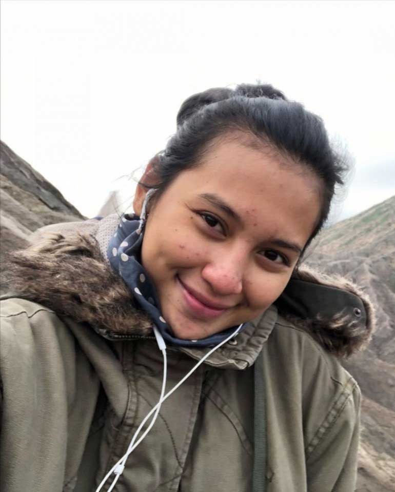 Indah permatasari Indah permatasari artis jerawatIndah permatasari artis jerawatIndah permatasari artis jerawatjerawat